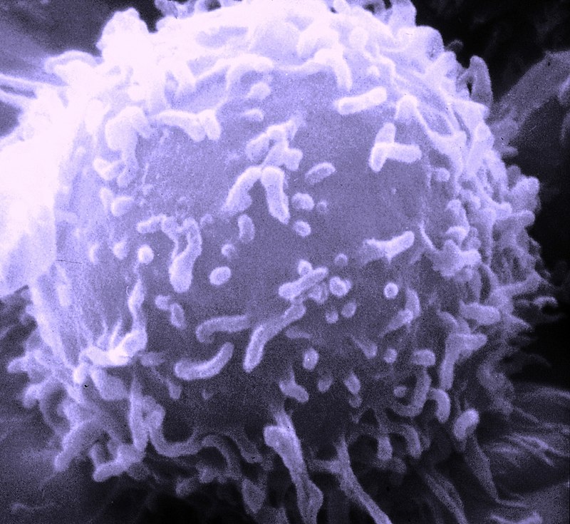 lymphocyte © https://fr.wikipedia.org/wiki/Lymphocyte#/media/Fichier:SEM_Lymphocyte.jpg