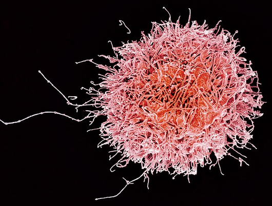 Cellule NK © https://fr.wikipedia.org/wiki/Lymphocyte_NK#/media/Fichier:Human_Natural_Killer_Cell_(29228845335).jpg