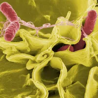 Pixabay - bactéries salmonella