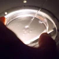 Préparation des ovocytes sous hotte stérile, avant la micro-injection des spermatozoïdes dans les ovocytes, le 30/11/2000, Rennes ©MARCEL MOCHET / AFP