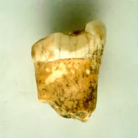 Première molaire de Néandertalien analysée pour cette étude - © Lourdes Montes