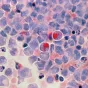 image d'illustration (cellules cancéreuses) - © National Cancer Institute via Unsplash